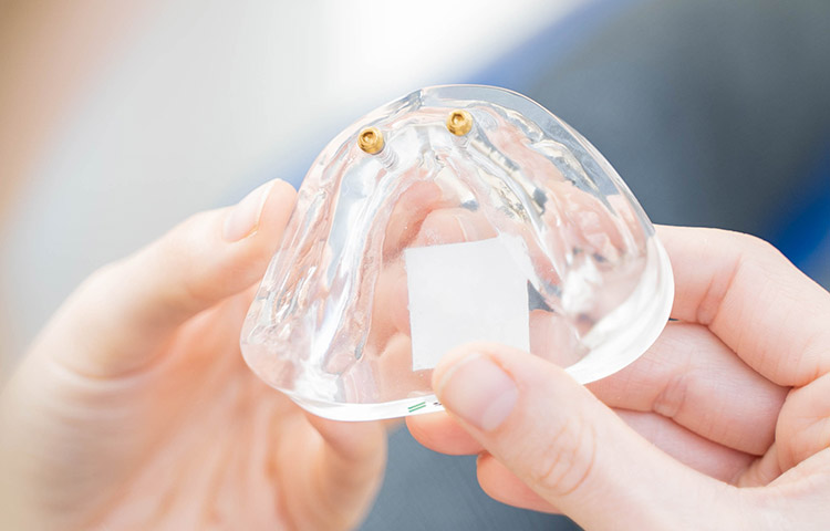 dr wiens kollegen zahnarzt eppelheim behandlungsspektrum leistung implantate