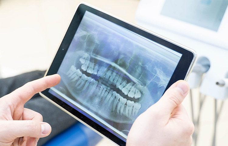 dr wiens kollegen zahnarzt eppelheim behandlungsspektrum leistung kieferchirurgie