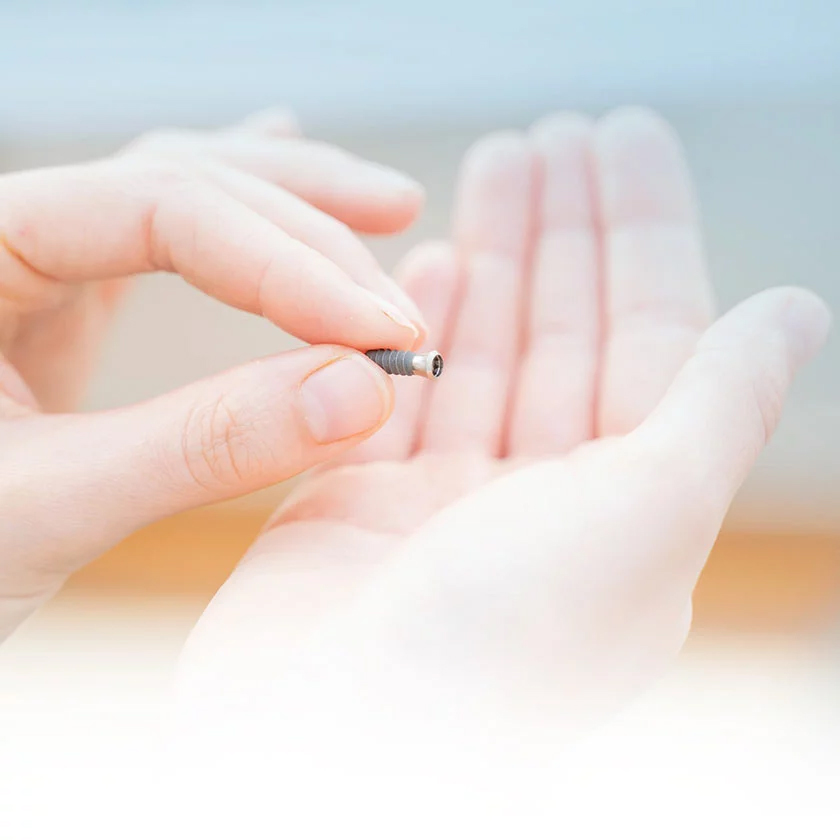 dr wiens zahnarzt eppelheim feste zaehne an einem tag